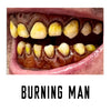 Burnt man costume teeth and fangs