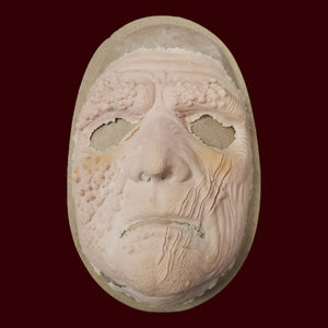 Foam latex prosthetic - diseased