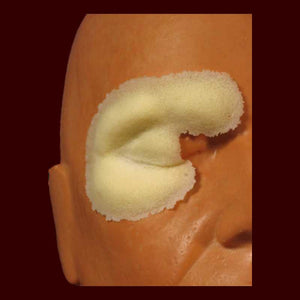 right swollen check latex prosthetic