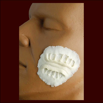 Bite Mark 1
