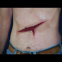 large slash wound appliance