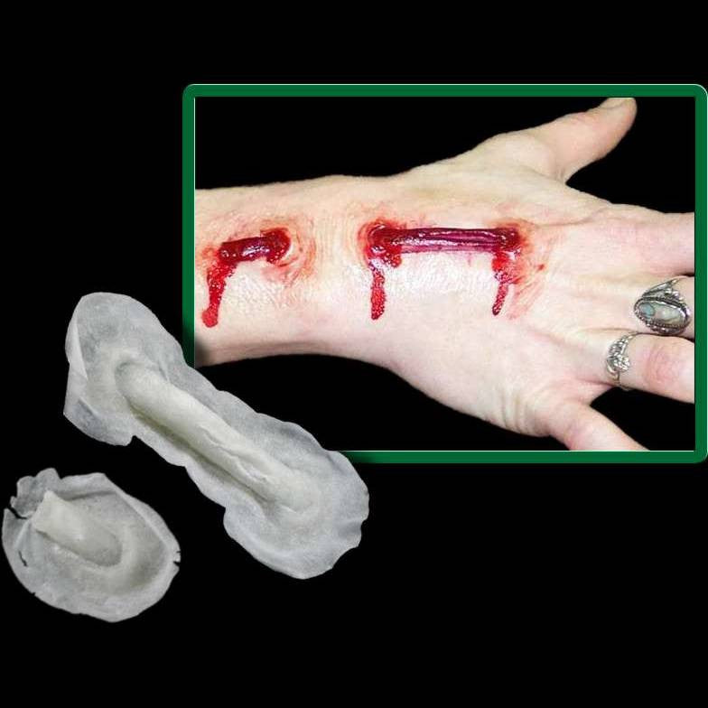 triple bypass michael davvy wound appliance